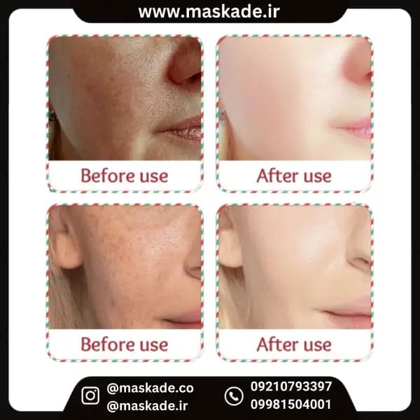 ماسک ورقه‌ای صورت یخی توت‌فرنگی ضدجوش و شفاف کننده پوست سادور — تصویر ۴