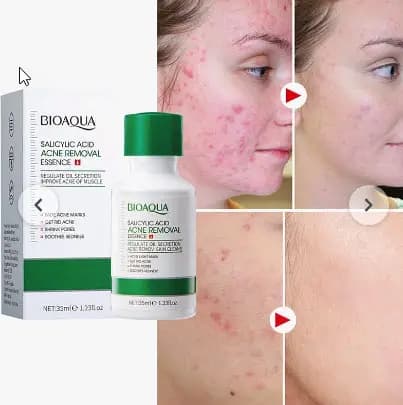 سرم صورت ضد جوش و آکنه سالیسیلیک اسید بیوآکوا حجم 35 میل