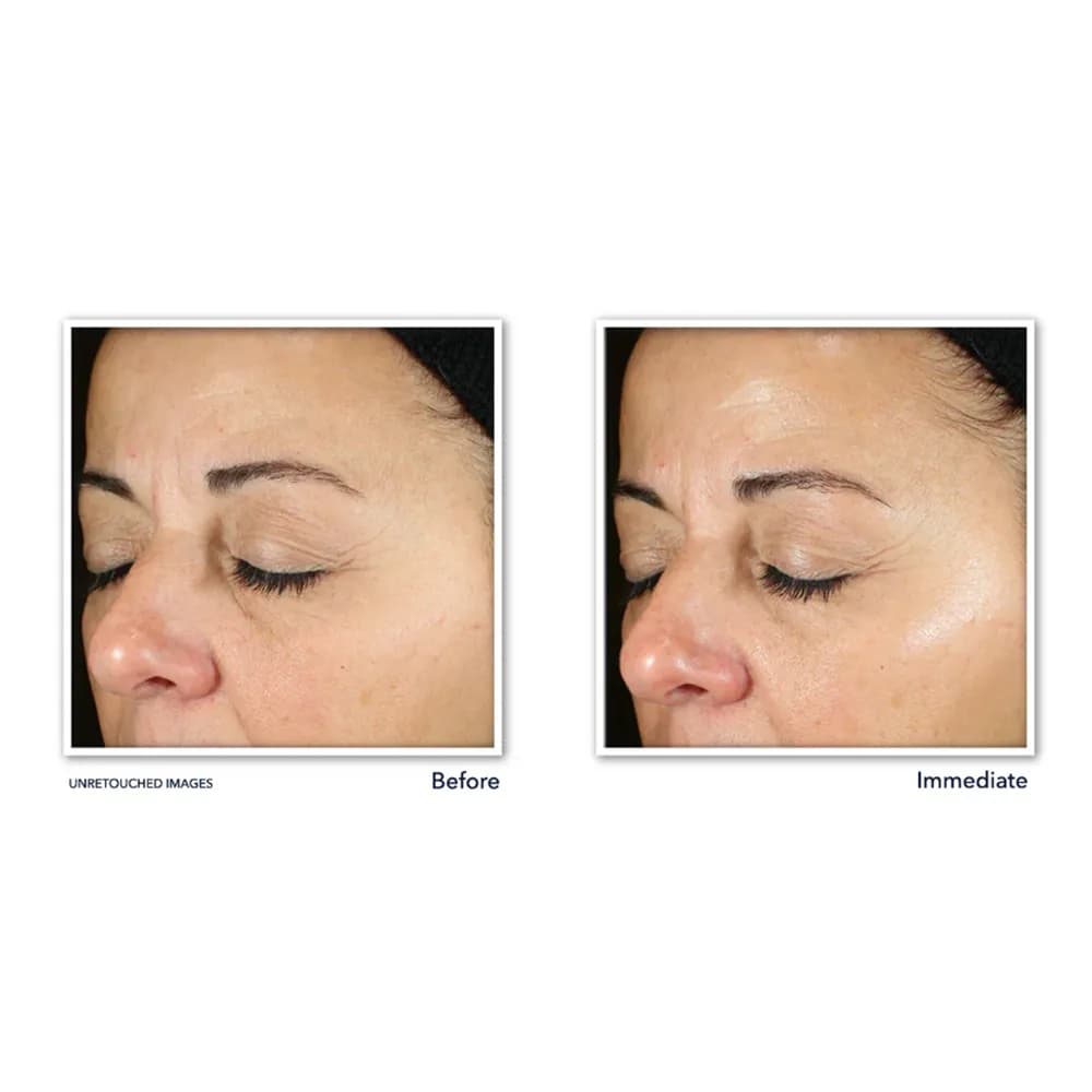 سرم ویتامین سی راک Roc روشن کننده و سفت کننده پوست سری مولتی کورکشن 10 درصد آمریکا اورجینال — تصویر ۴