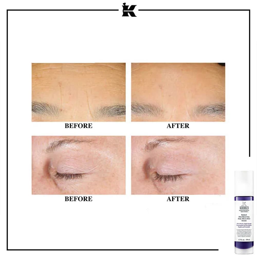 سرم رتینول ضد چروک کیلز Kiehls لیفت کننده قوی، جوانساز، ضد لک، مناسب دور چشم خرید از فرانسه اورجینال — تصویر ۶