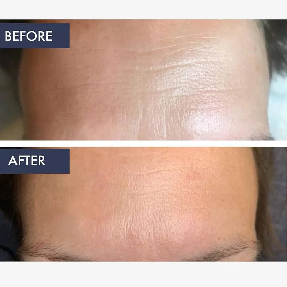 سرم رتینول ضد چروک کیلز Kiehls لیفت کننده قوی، جوانساز، ضد لک، مناسب دور چشم خرید از فرانسه اورجینال — تصویر ۴