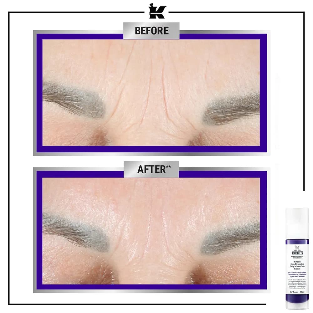 سرم رتینول ضد چروک کیلز Kiehls لیفت کننده قوی، جوانساز، ضد لک، مناسب دور چشم خرید از فرانسه اورجینال — تصویر ۷