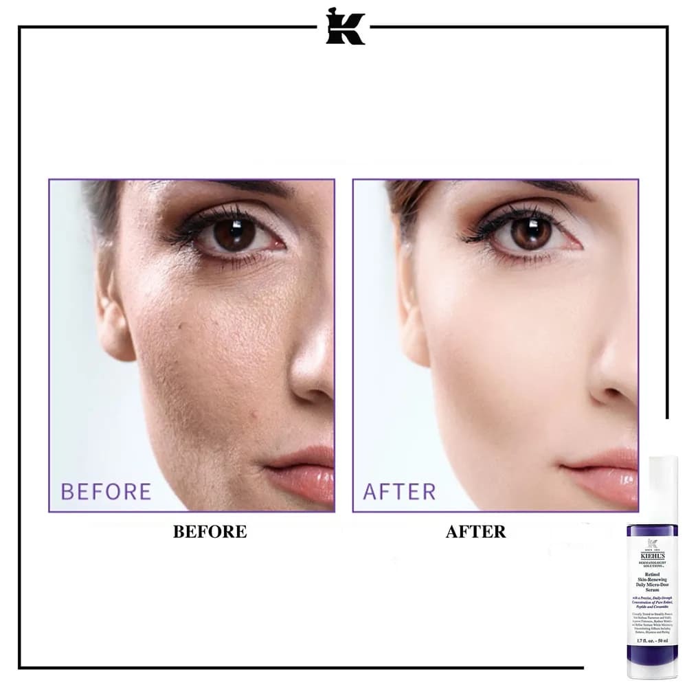 سرم رتینول ضد چروک کیلز Kiehls لیفت کننده قوی، جوانساز، ضد لک، مناسب دور چشم خرید از فرانسه اورجینال — تصویر ۳