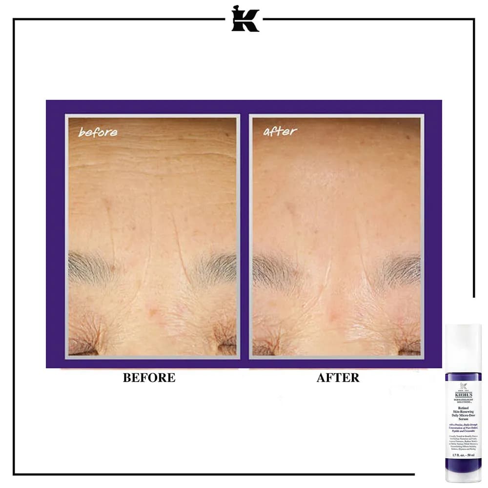 سرم رتینول ضد چروک کیلز Kiehls لیفت کننده قوی، جوانساز، ضد لک، مناسب دور چشم خرید از فرانسه اورجینال — تصویر ۸