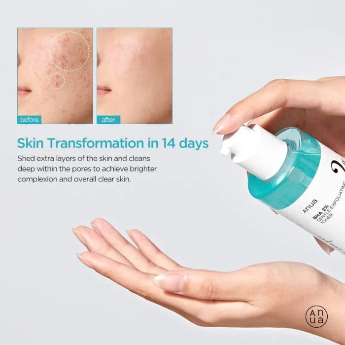 تونر لایه بردار آنوا BHA 2% حجم 150میلی لیتر — تصویر ۵