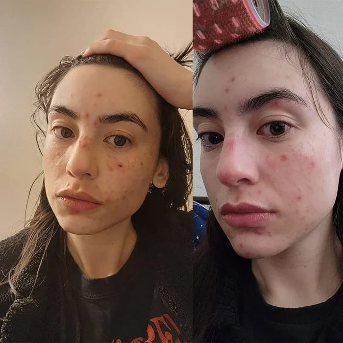 سرم نیاسینامید ۱۵ کوزارکس حجم 20 میلی لیتر — تصویر ۲
