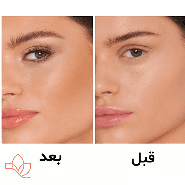 برنزر شارلوت تیلبری — تصویر ۵