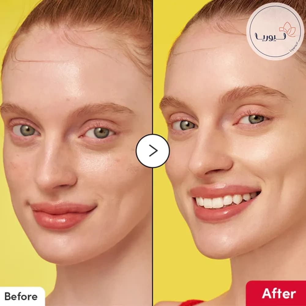 سرم روشن‌ کننده اکوال بری Eqqual Berry — تصویر ۵