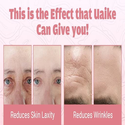 دستگاه لیفت و جوانسازی صورت Uaike مدل T1 High Frequency مناسب استفاده خانگی — تصویر ۱۰