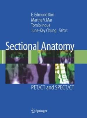 دانلود کتاب Sectional Anatomy: PET CT and SPECT CT