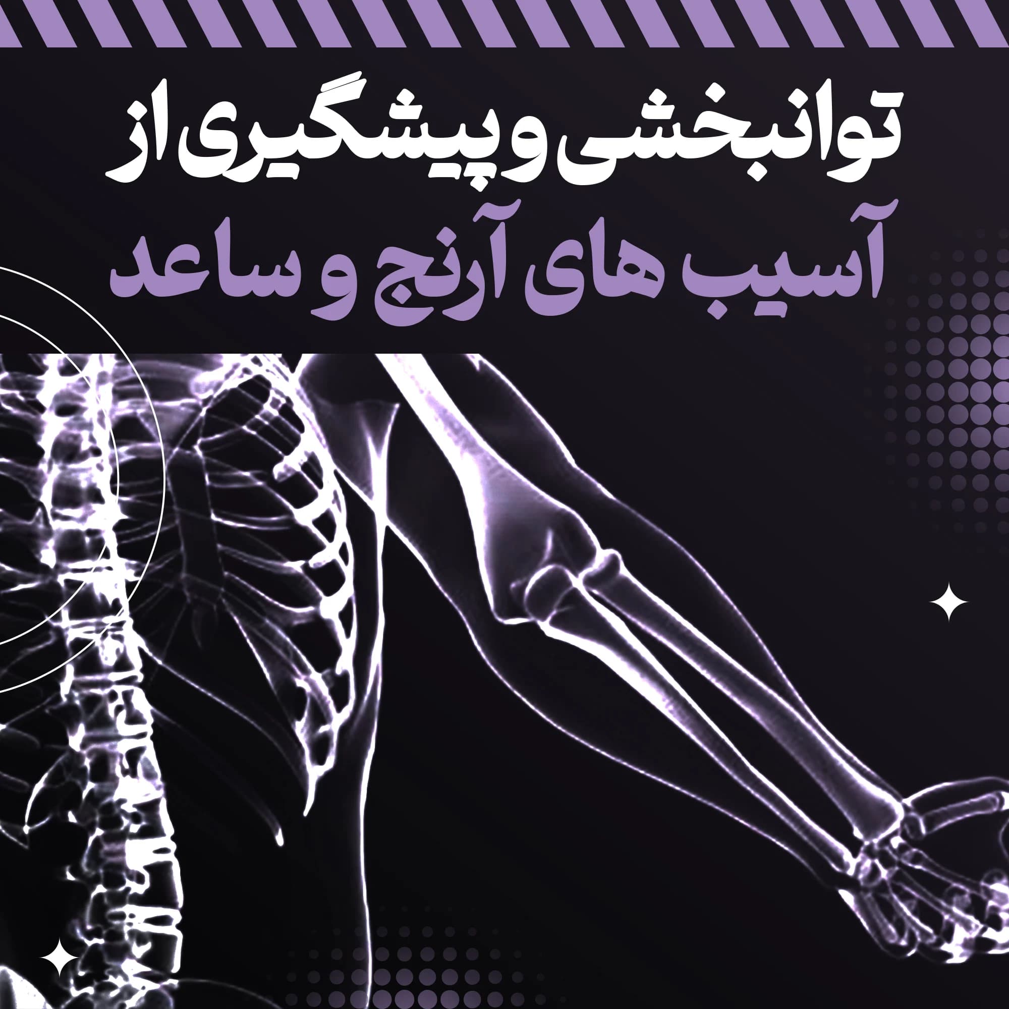 پکیج بازتوانی و پیشگیری آسیب‌های آرنج و ساعد