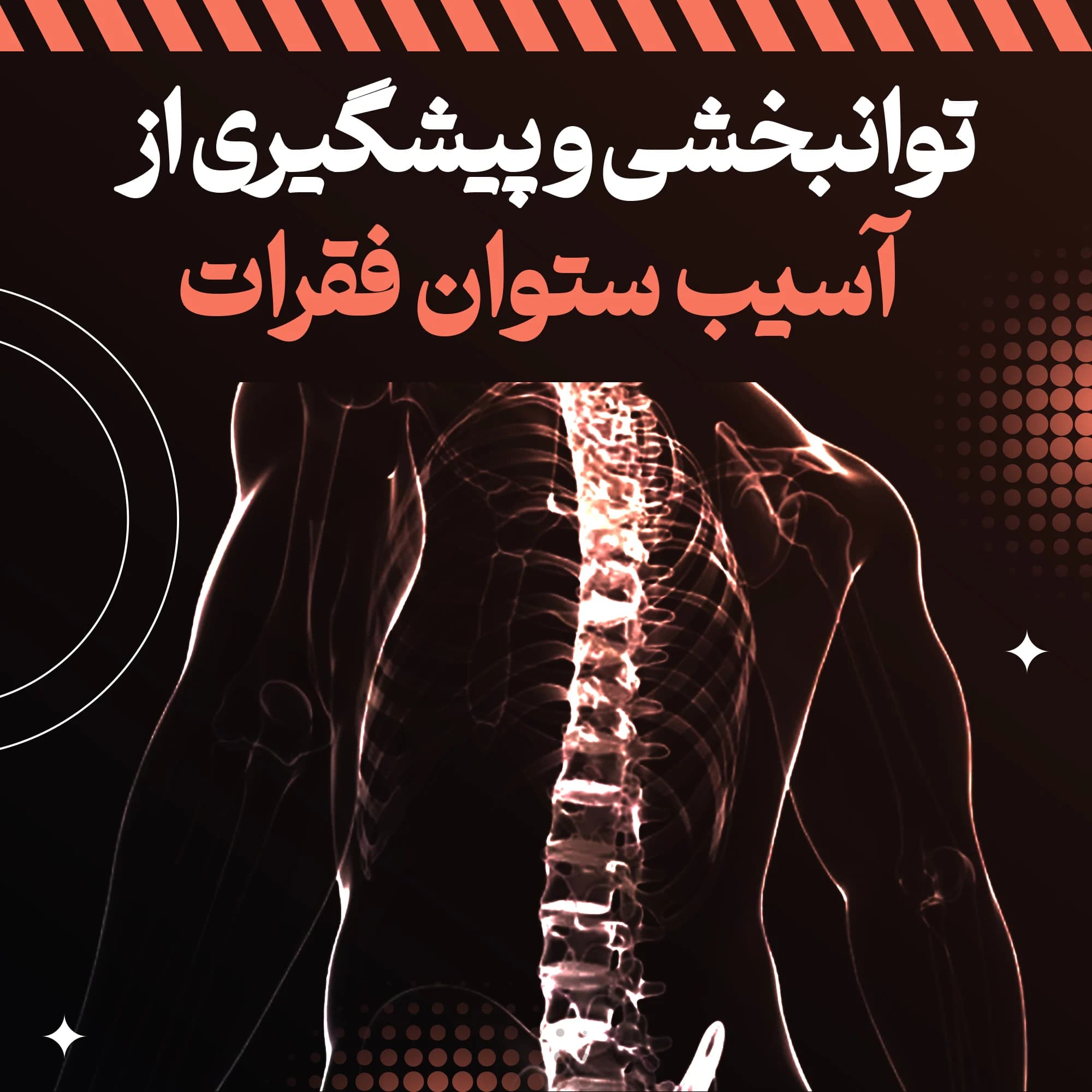 پکیج بازتوانی و پیشگیری آسیب‌های ستون فقرات