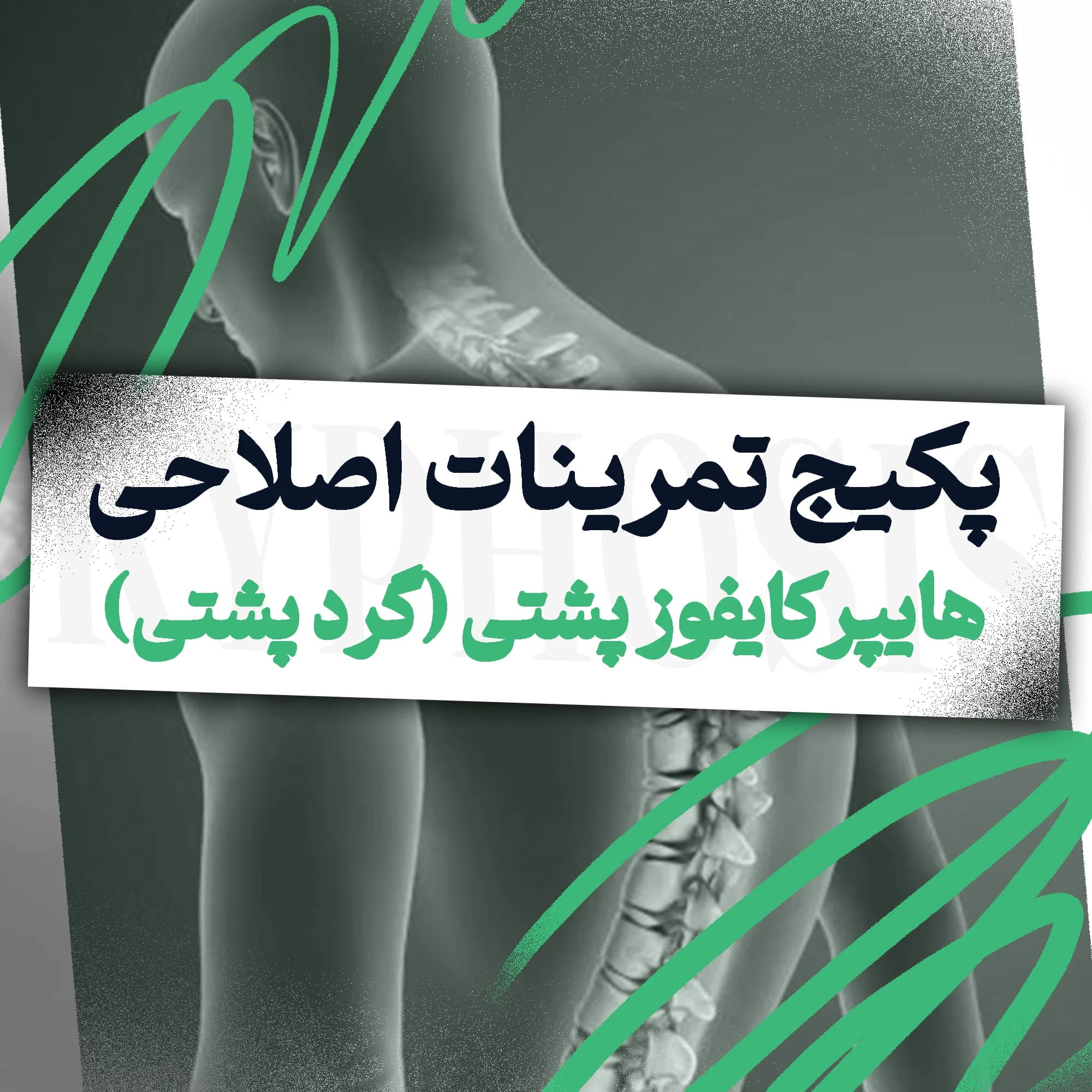 تمرینات اصلاحی هایپرکایفوز پشتی (گرد پشتی)
