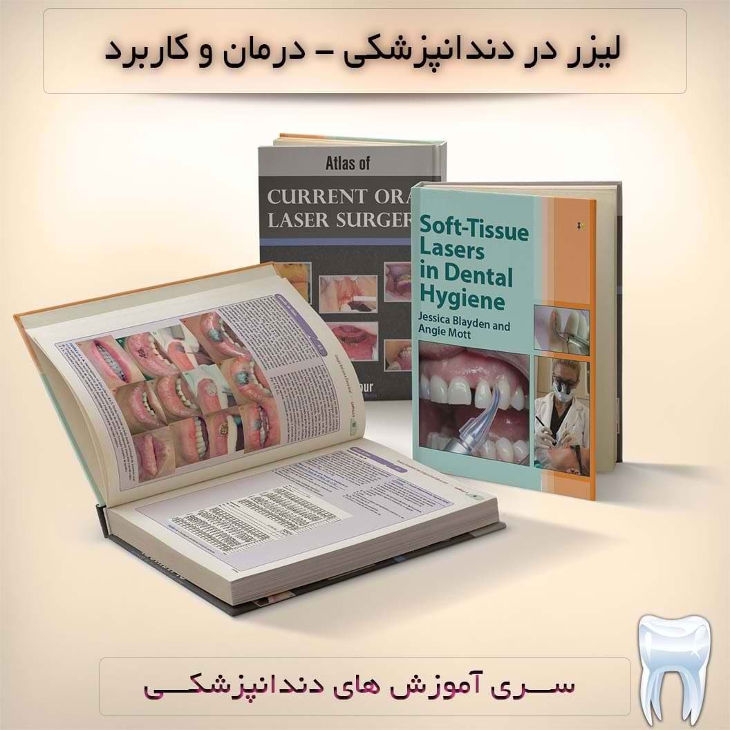 کاربرد لیزر در دندانپزشکی – کتاب های لیزر : نسخه دانلودی