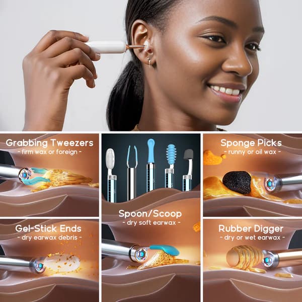 گوش پاک کن هوشمند Bebird EarSight Complete — تصویر ۵