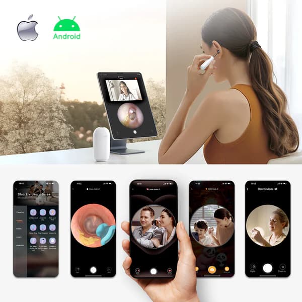 گوش پاک کن هوشمند Bebird EarSight Complete — تصویر ۷