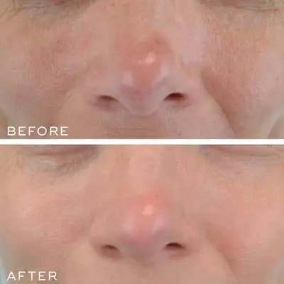 سرم شب کریستال رتینال 10 ضد چروک و سفت کننده مدیک 8 — تصویر ۴