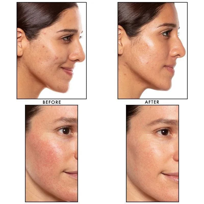 سرم رتینول ساندی ریلی اصل اروپایی حجم ۱۵میل SUNDAY RILEY A+ HIGH_DOSE RETINOL SERUM — تصویر ۱۰