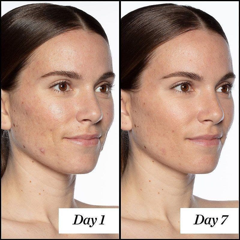 سرم رتینول ساندی ریلی اصل اروپایی حجم ۱۵میل SUNDAY RILEY A+ HIGH_DOSE RETINOL SERUM — تصویر ۴