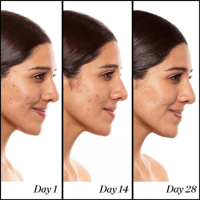 سرم رتینول ساندی ریلی اصل اروپایی حجم ۱۵میل SUNDAY RILEY A+ HIGH_DOSE RETINOL SERUM — تصویر ۶