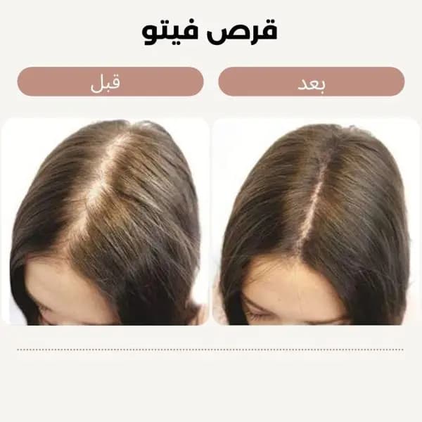 قرص اصل ایتالیایی – ضد ریزش و تقویت‌کننده مو و ناخن — تصویر ۳