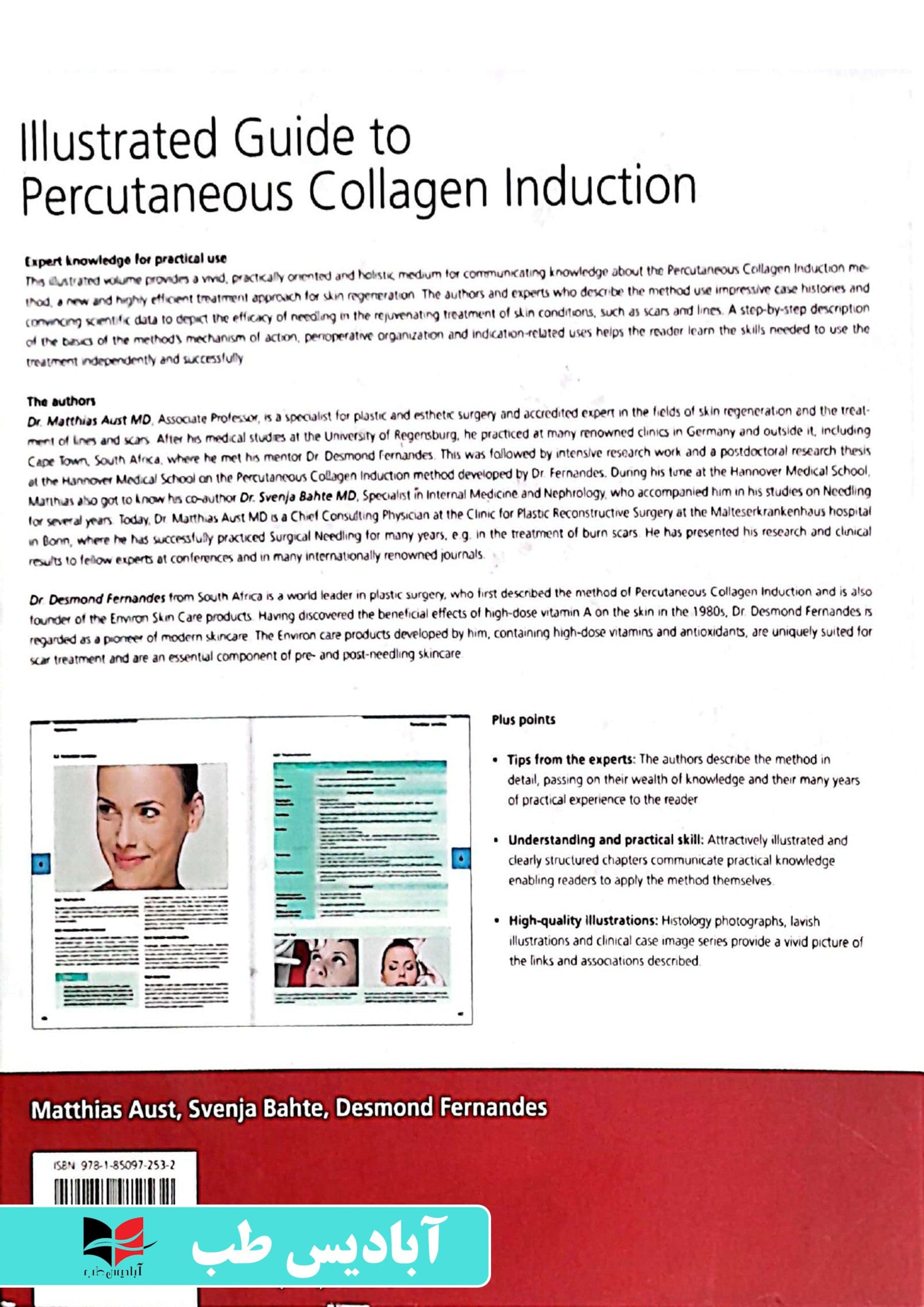 Illustrated Guide to Percutaneous Collagen Induction: Basics / Indications / Uses (Aesthetic Methods for Skin Rejuvenation) 1st Edition | راهنمای مصور برای القای کلاژن از راه پوست: مبانی / موارد مصرف — تصویر ۲