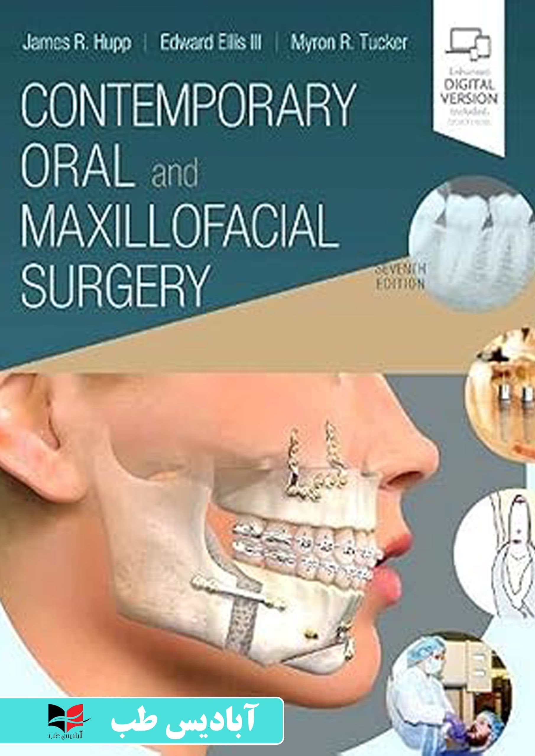Contemporary Oral and Maxillofacial Surgery 7th Edition | جراحی دهان فک و صورت پیترسون هاپ 2019