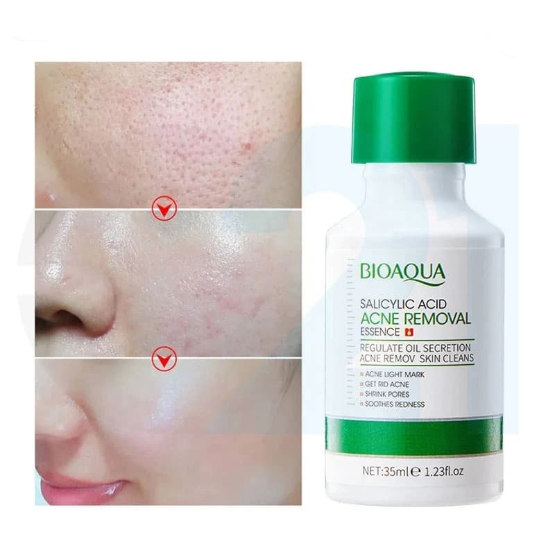 تونر ضد جوش سالیسیلیک اسید برند Bioaqua — تصویر ۲