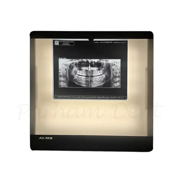 نگاتسکوپ اتوماتیک عاج طب مدل AT-PG-CTX — تصویر ۲