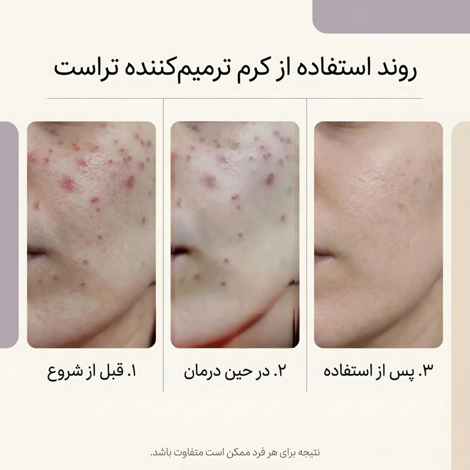 کرم ترمیم کننده تراست trust — تصویر ۳