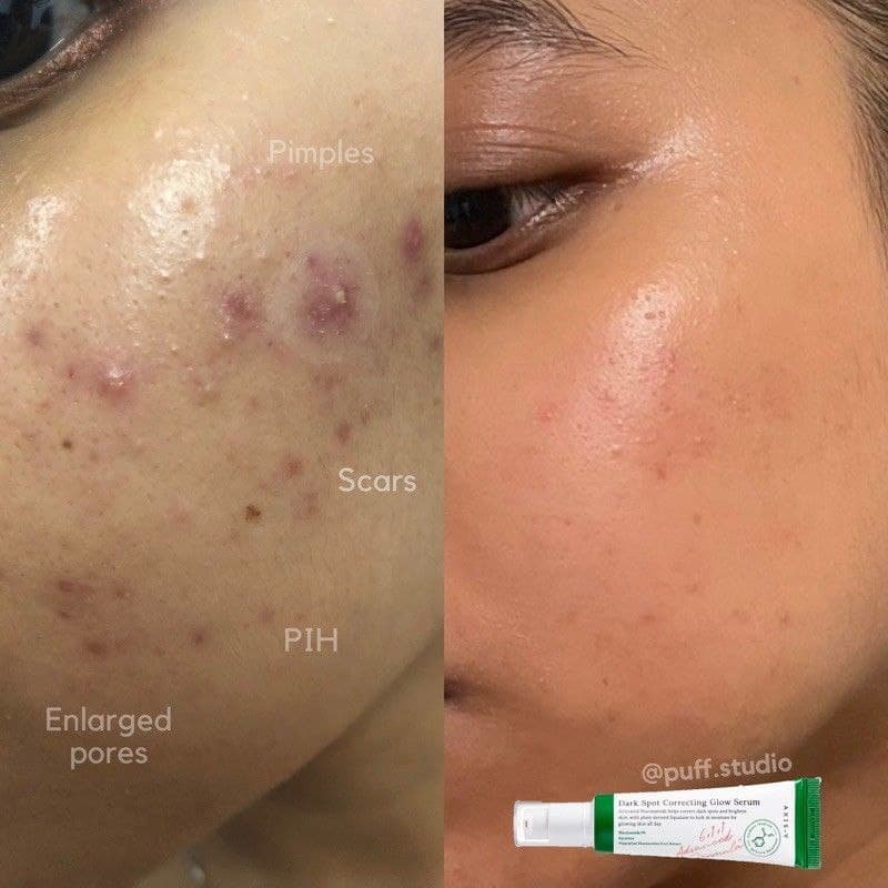 سرم ضد لک Dark Spot Correcting اکسیس وای Axis-y — تصویر ۴