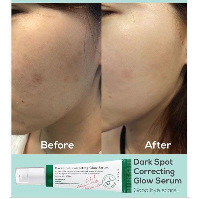 سرم ضد لک Dark Spot Correcting اکسیس وای Axis-y — تصویر ۳