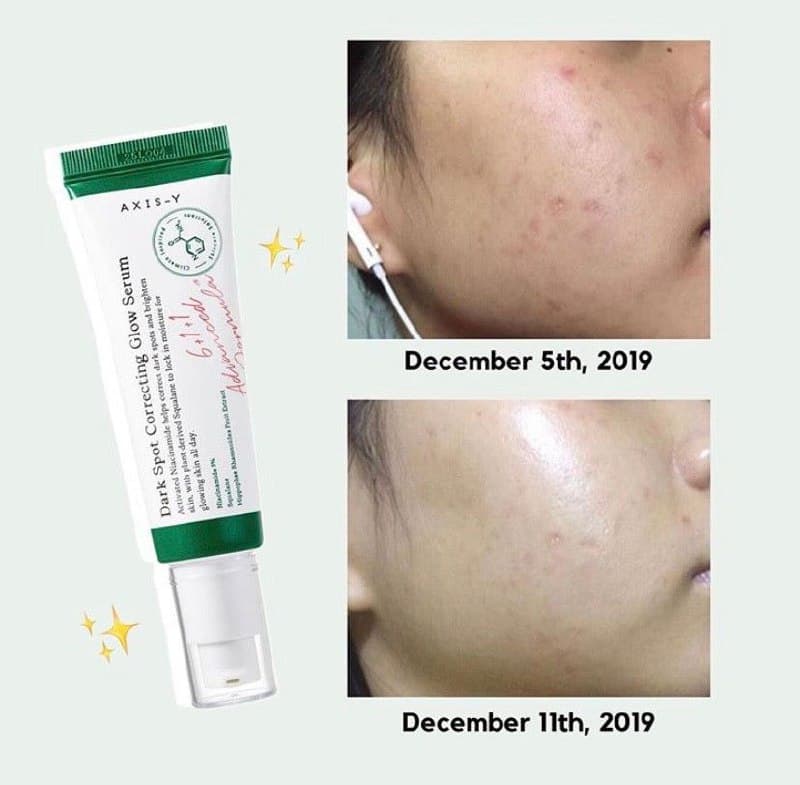 سرم ضد لک Dark Spot Correcting اکسیس وای Axis-y — تصویر ۶