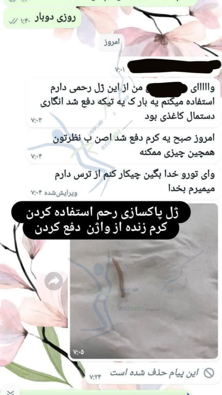 ژل ماریانا ژل بهداشتی ماریانا تنگ کننده قوی 140 میلی — تصویر ۲