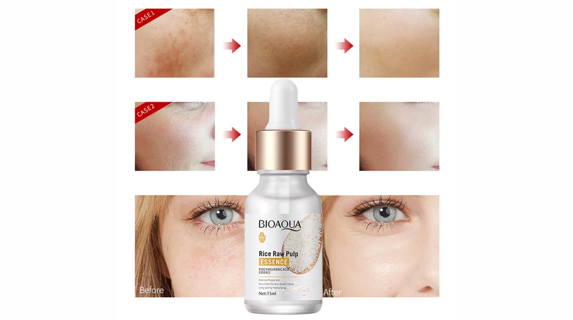 سرم بازسازی پوست صورت عصاره برنج بیوآکوآ bioaqua — تصویر ۵