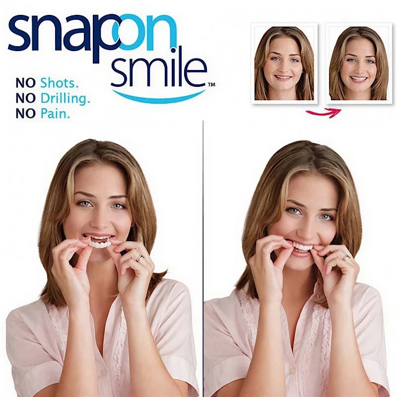 لمینت دندان دو فک مدل Snap on Smile کدN694 — تصویر ۵