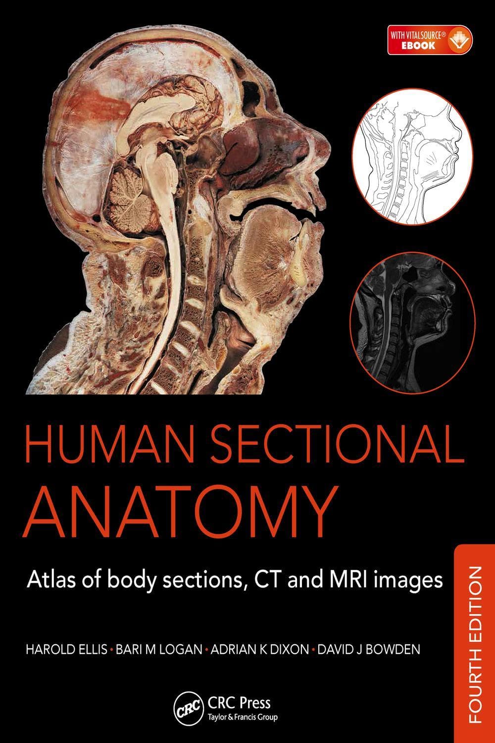آناتومی مقطعی بدن انسان ۲۰۱۵ <br> Human Sectional Anatomy 2015