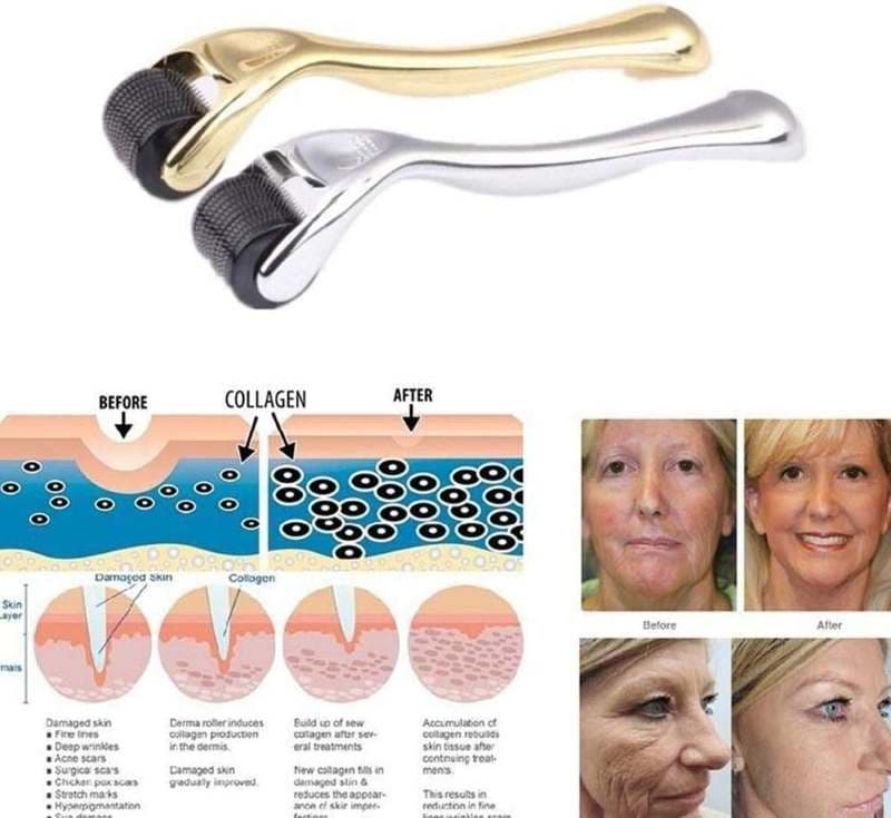 درما رولر NEEDLES 540 ماساژ زیبایی صورت تیتانیومی ۵۴۰ میکرو سوزن — تصویر ۴