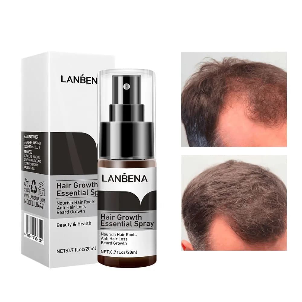 اسپری تقویت و رشد موی لانبنا Essential Spray حجم ۲۰ میل
