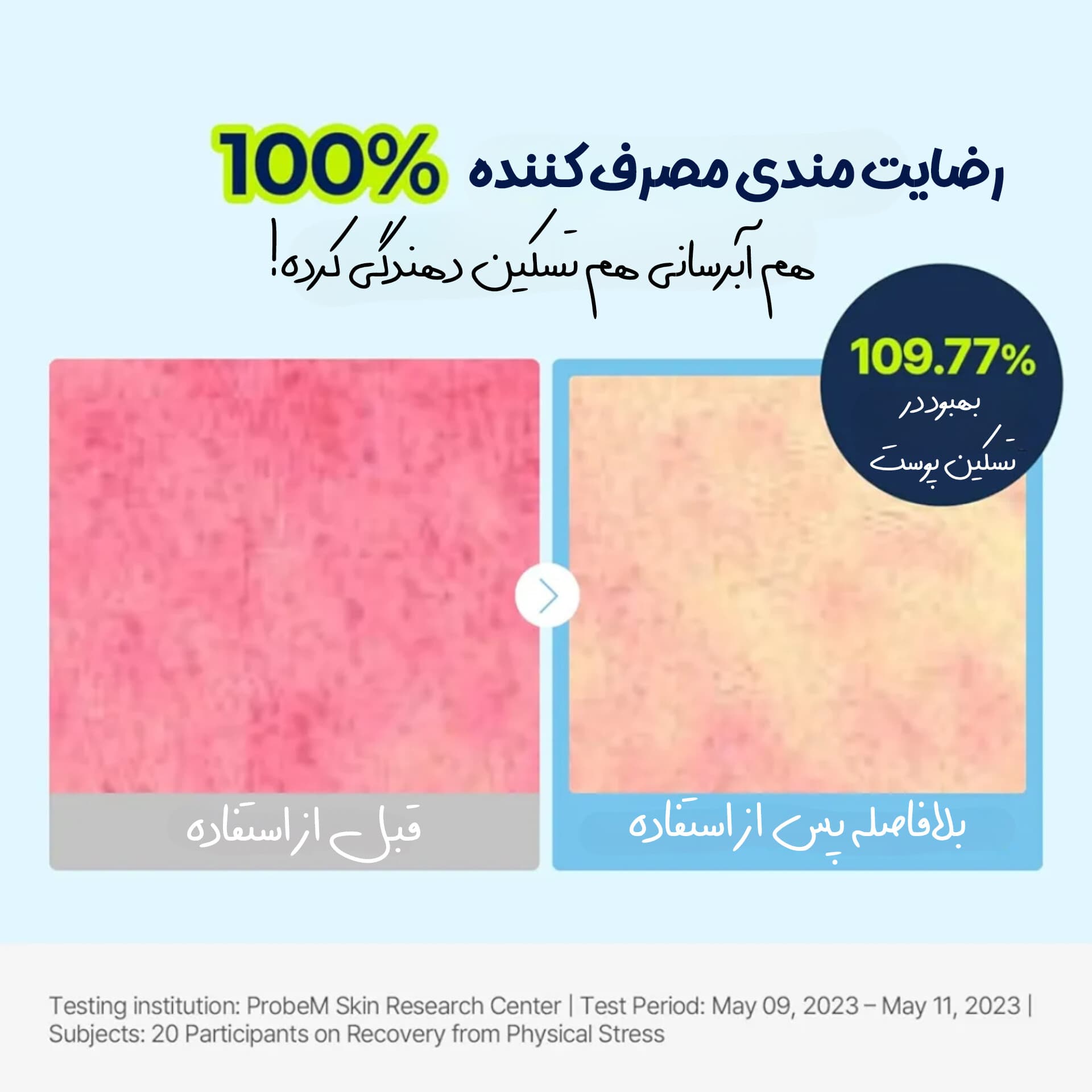 ژل مرطوب کننده و تسکین دهنده حاوی هیالورونیک اسید توریدن — تصویر ۲