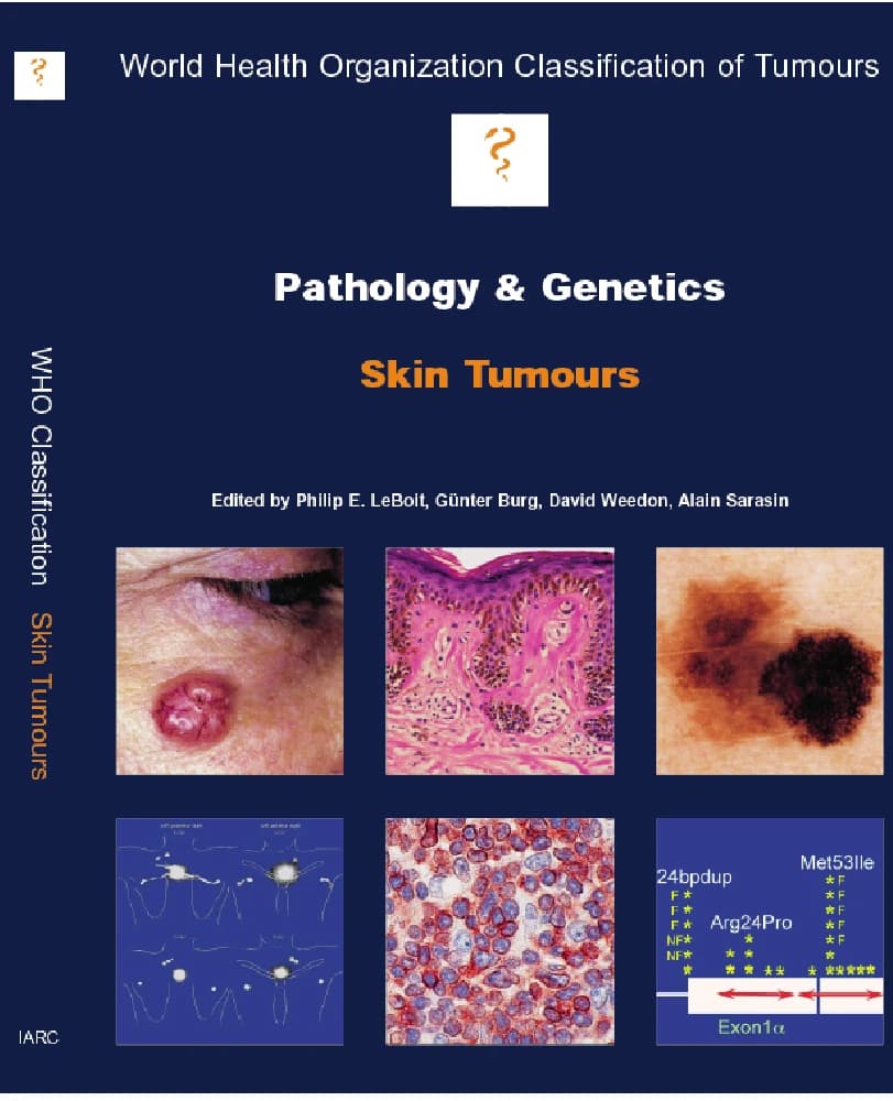 دانلود کتاب WHO Pathology and Genetics: Skin tumors (پاتولوژی و ژنتیک WHO: تومورهای پوستی) نسخه انگلیسی PDF