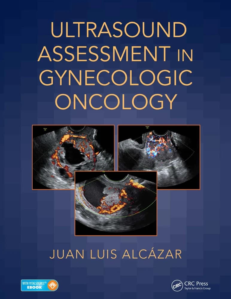 کتاب ULTRASOUND ASSESSMENT IN GYNECOLOGIC ONCOLOGY (ارزیابی سونوگرافی در انکولوژی زنان) نسخه انگلیسی PDF