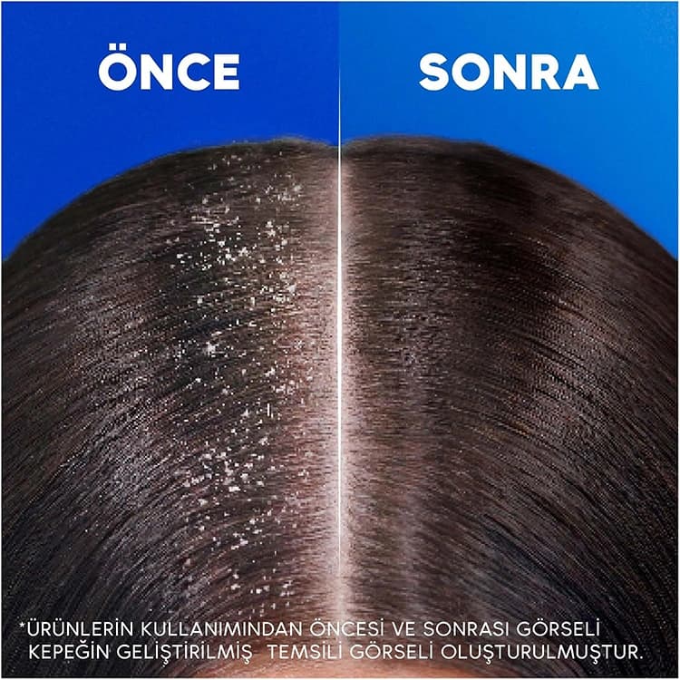 شامپو Head and Shoulders مدل Mentol Ferahligi حجم 330 میلی لیتر — تصویر ۴