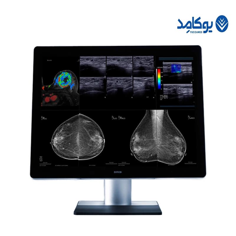 مانیتور مدیکال برند Barco مخصوص اندوسکوپی لاپاروسکوپی MRI Compatible