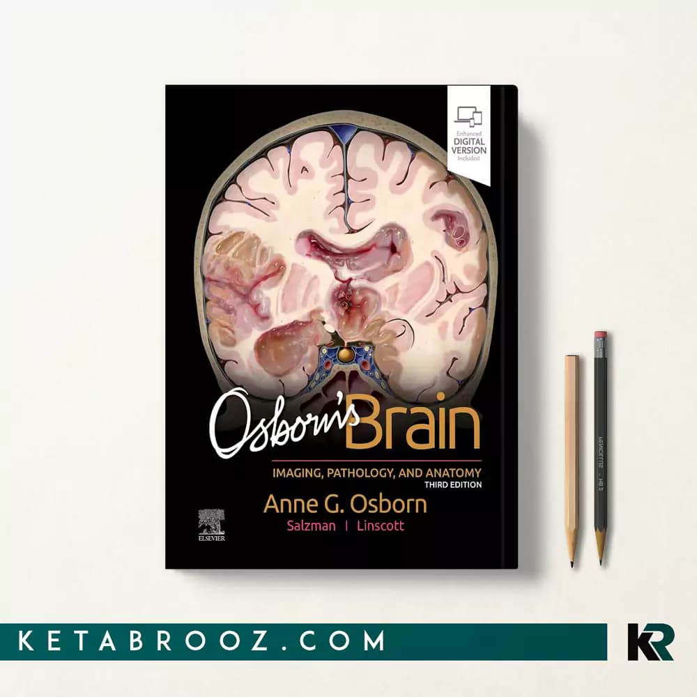 کتاب Osborn’s Brain