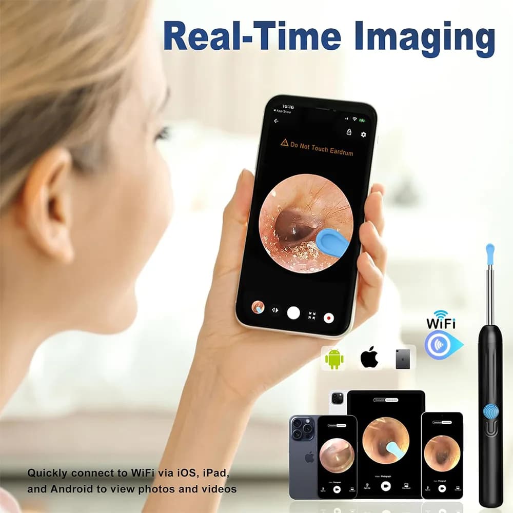 دوربین تمیزکننده گوش با دوربین HD و چراغ LED برند Ntgiso مدل 1080P — تصویر ۶