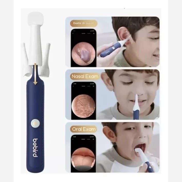 گوش پاک کن هوشمند Bebird R135 — تصویر ۳