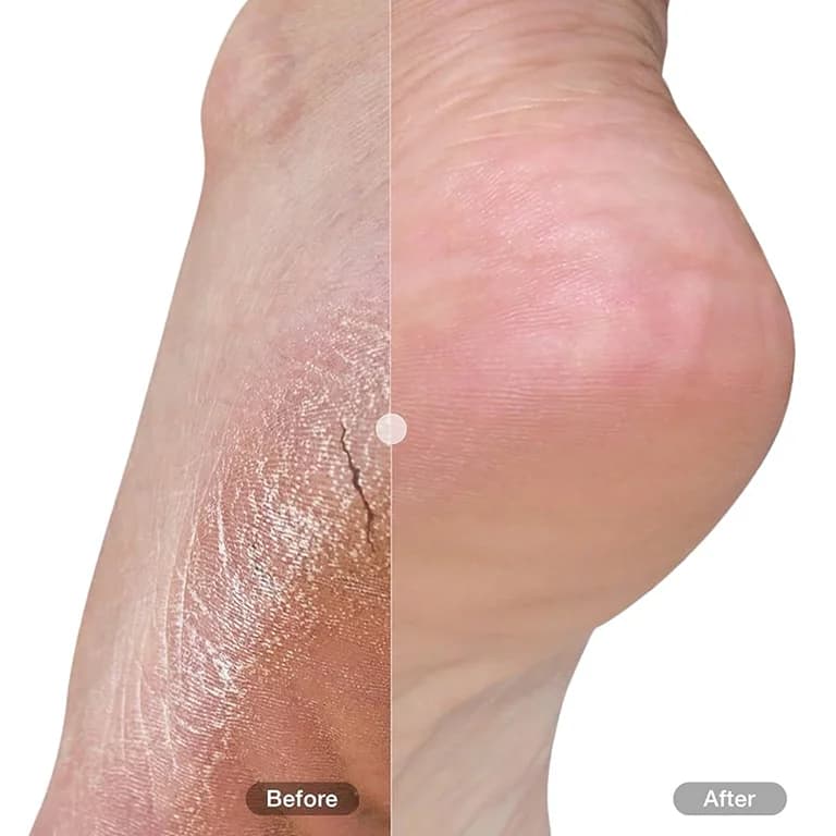 کرم ترمیم کننده ترک پا و پاشنه قوی دوييت 75 ميل DUIT Foot and Heel Cream Plus High Potency 75ml — تصویر ۲