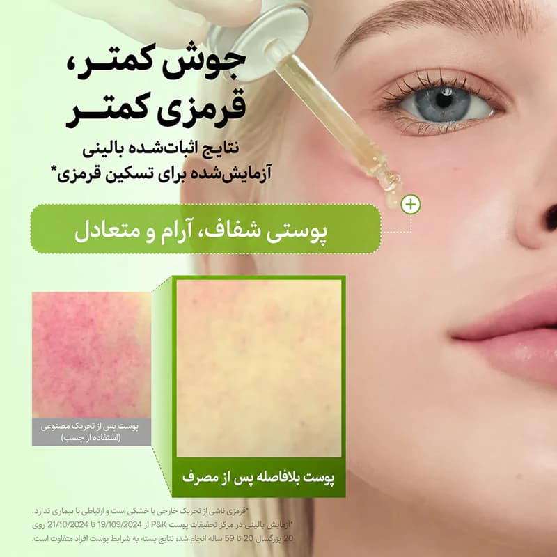 سرم آزلائیک اسید آنوا سبز ضد جوش و لک 30 میل اصل کره جنوبی — تصویر ۸