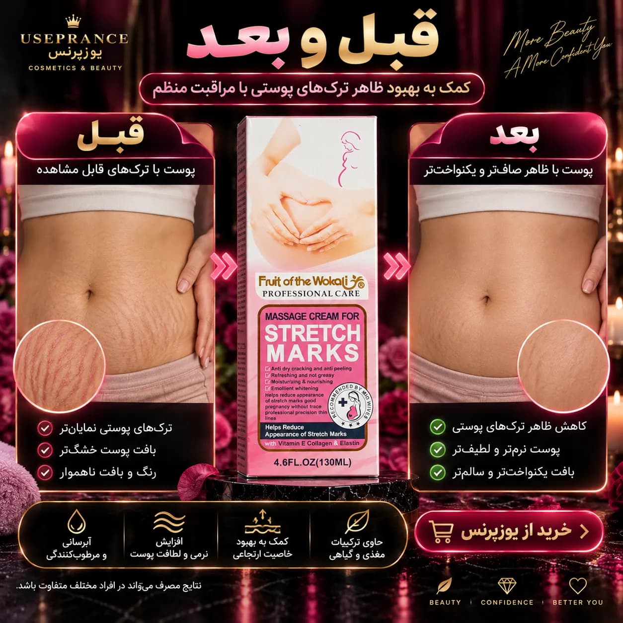 کرم رفع ترک شکم ووکالی 130 میل | مراقبت از ترک پوستی و آبرسانی — تصویر ۴